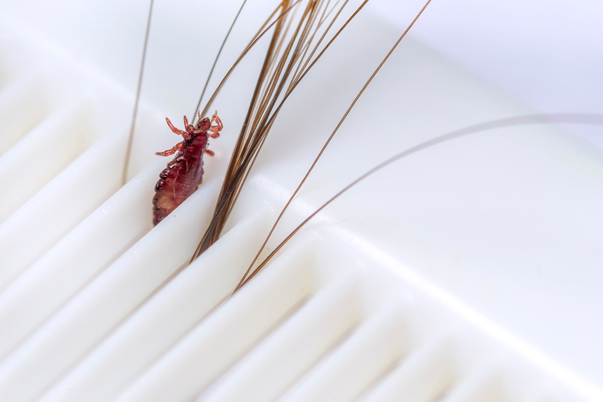 Floh steckt mit Haaren in einem Kamm fest