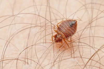 Bettwanzen: Alles, was Sie wissen müssen