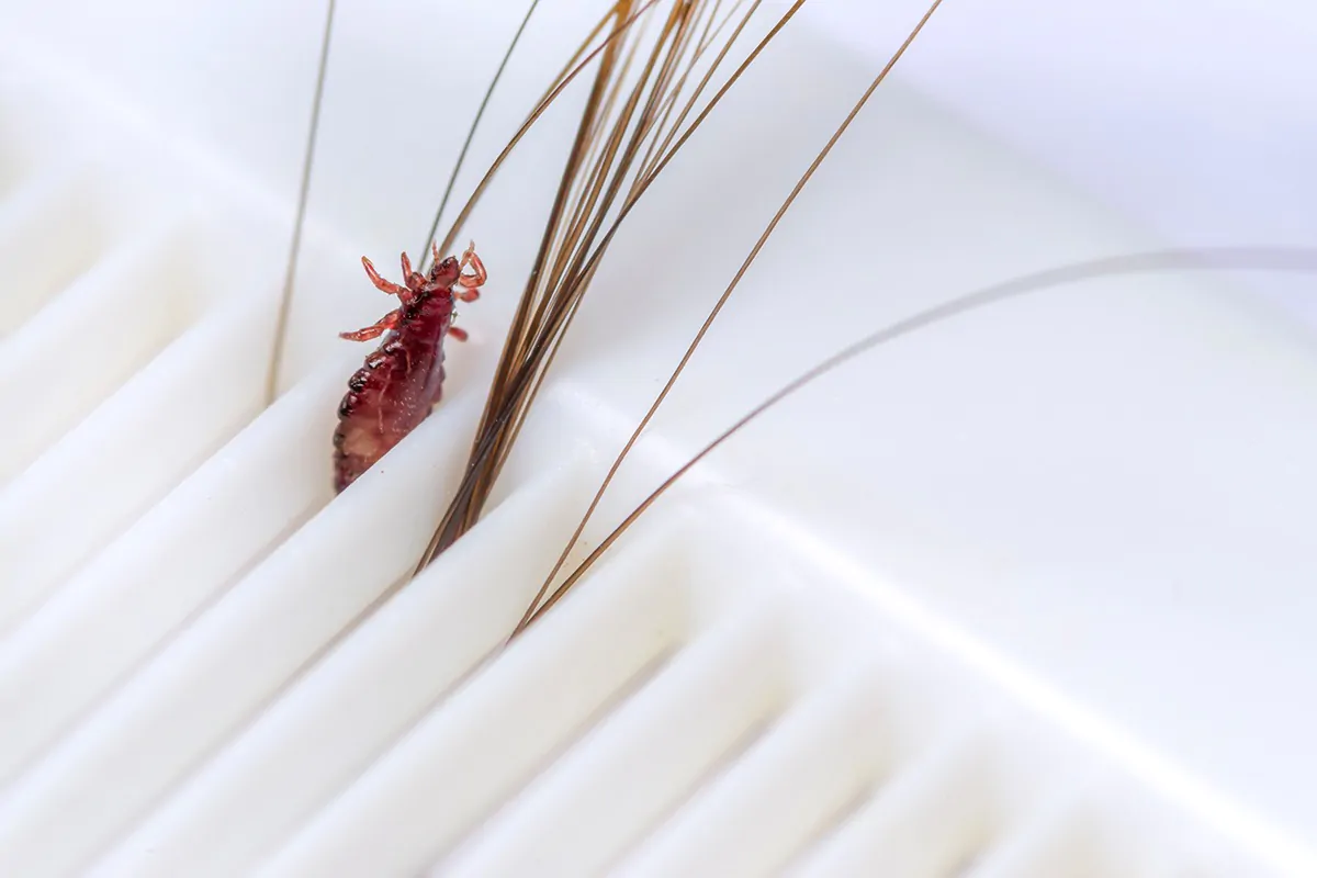 Floh steckt mit Haaren in einem Kamm fest